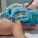 RÉANIMATION DU NOUVEAU-NÉ EN SALLE DE NAISSANCE - CHU REIMS